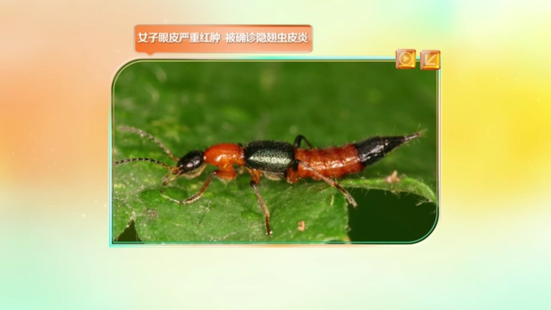 一巴掌拍出大麻烦！隐翅虫皮炎急救法